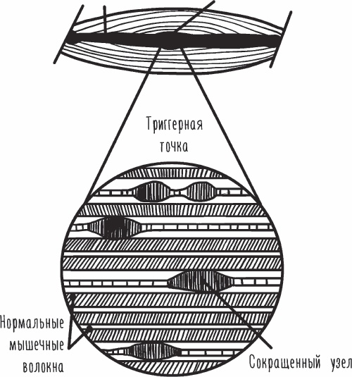 Благодарный позвоночник. Как навсегда избавить его от боли. Домашняя кинезиология