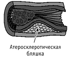 Фрукторианство. Новый взгляд на эволюцию питания человека