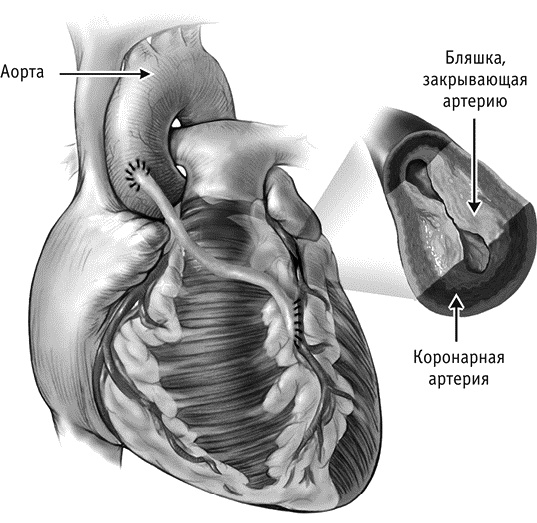 Фрукторианство. Новый взгляд на эволюцию питания человека