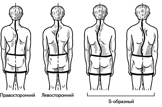 Жизнь без боли в спине. Лечение сколиоза, остеопороза, остеохондроза, межпозвонковой грыжи без операции