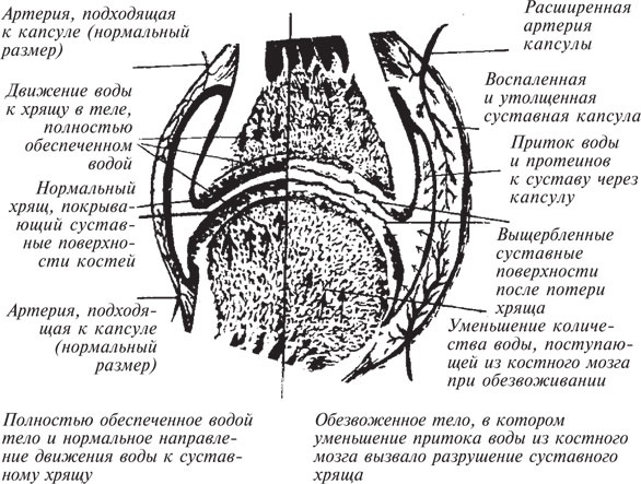 Как лечить боли в спине и ревматические боли в суставах