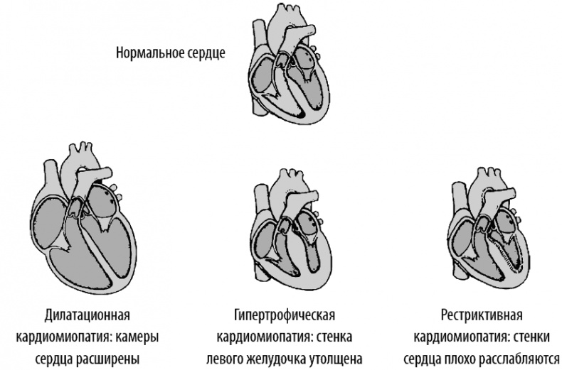 Сердце и сосуды. Большая энциклопедия здоровья