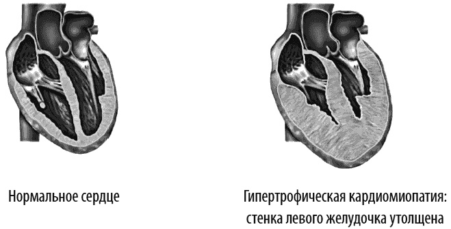 Сердце и сосуды. Большая энциклопедия здоровья