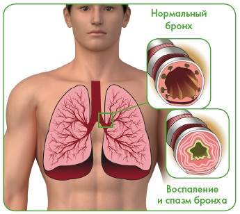 Энциклопедия диагностики и лечения от А до Я