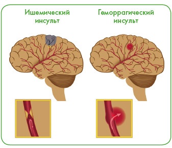 Энциклопедия диагностики и лечения от А до Я