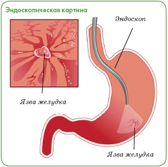 Энциклопедия диагностики и лечения от А до Я