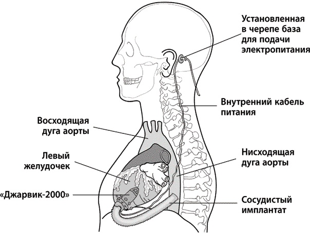 Хрупкие жизни. Истории кардиохирурга о профессии, где нет места сомнениям и страху