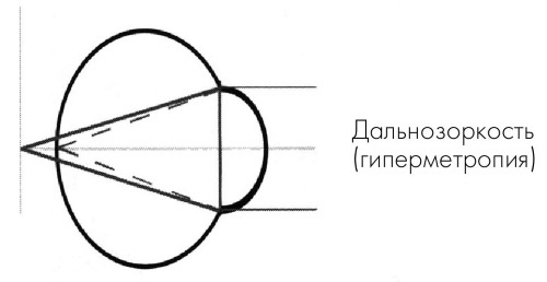 Как учиться и не испортить зрение