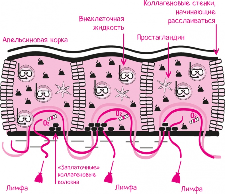 Целлюлит. Циничный оберег от главного врага женщин