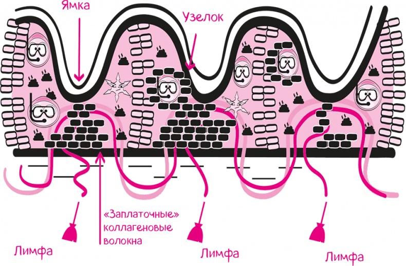 Целлюлит. Циничный оберег от главного врага женщин