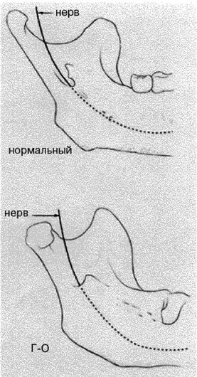 Эректус бродит между нами. Покорение белой расы