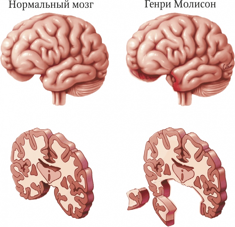 Мозг. Ваша личная история