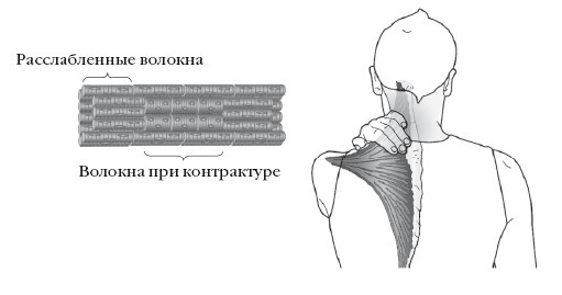 Диагностика и лечение позвоночника. Уникальная система доктора А. М. Уриа