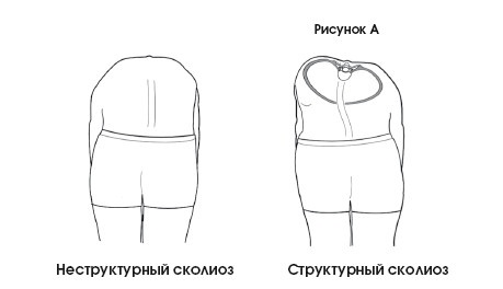 Диагностика и лечение позвоночника. Уникальная система доктора А. М. Уриа