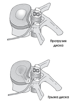 Диагностика и лечение позвоночника. Уникальная система доктора А. М. Уриа