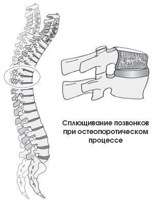 Диагностика и лечение позвоночника. Уникальная система доктора А. М. Уриа