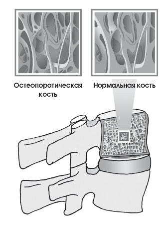 Диагностика и лечение позвоночника. Уникальная система доктора А. М. Уриа