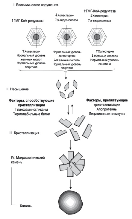 Неалкогольная жировая болезнь печени