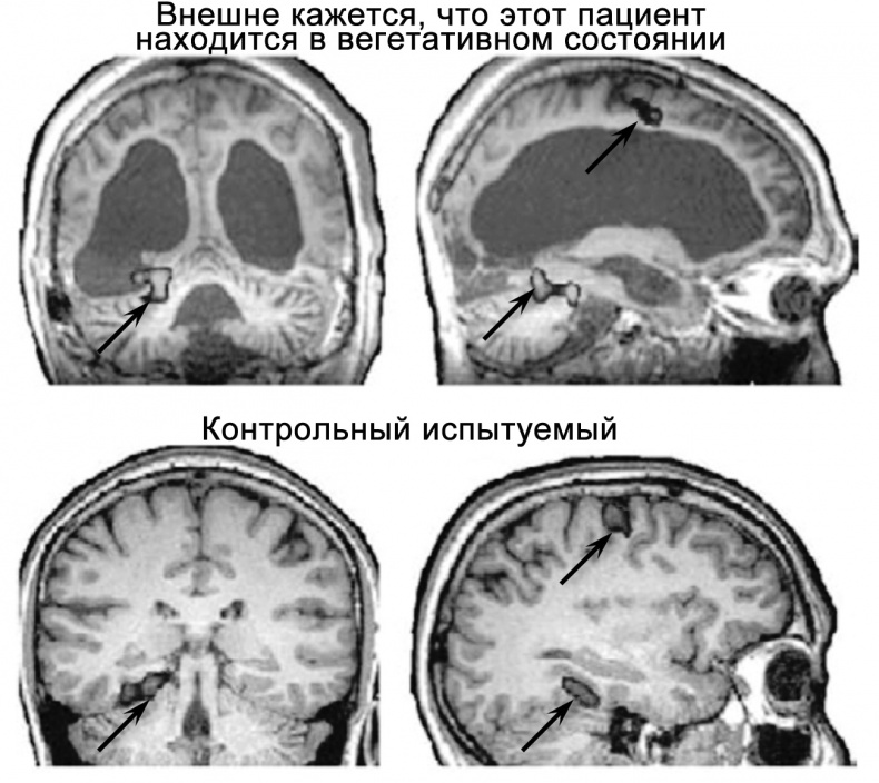 Сознание и мозг. Как мозг кодирует мысли