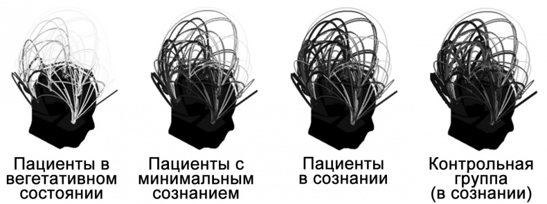 Сознание и мозг. Как мозг кодирует мысли