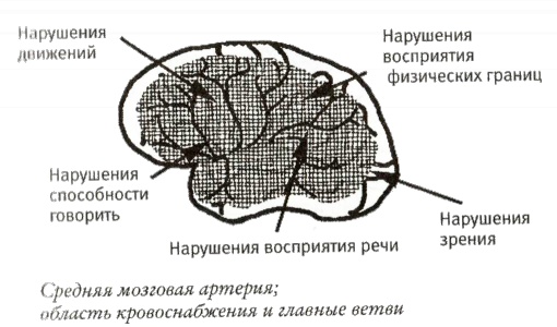 Мой инсульт был мне наукой. История собственной болезни, рассказанная нейробиологом