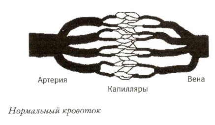 Мой инсульт был мне наукой. История собственной болезни, рассказанная нейробиологом