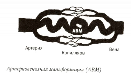 Мой инсульт был мне наукой. История собственной болезни, рассказанная нейробиологом