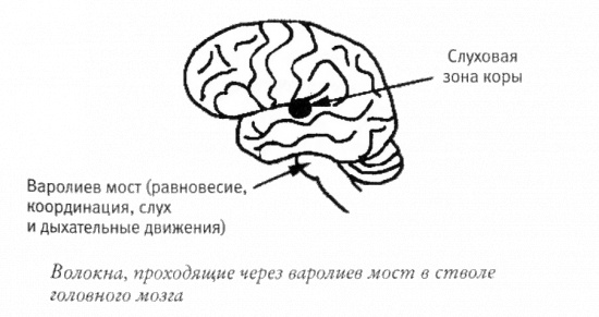 Мой инсульт был мне наукой. История собственной болезни, рассказанная нейробиологом