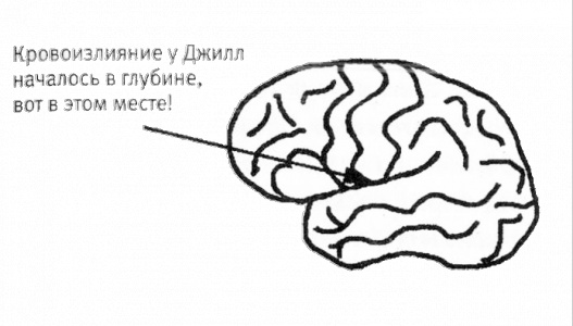 Мой инсульт был мне наукой. История собственной болезни, рассказанная нейробиологом