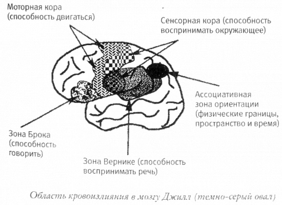 Мой инсульт был мне наукой. История собственной болезни, рассказанная нейробиологом