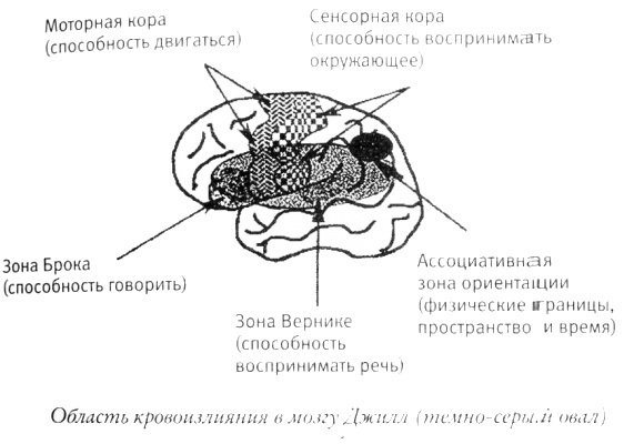 Мой инсульт был мне наукой. История собственной болезни, рассказанная нейробиологом