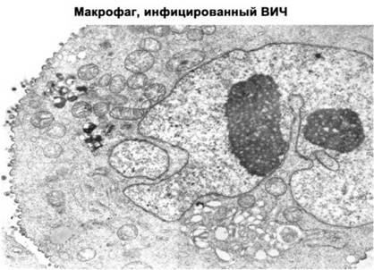 Имя ему СПИД. Четвертый всадник Апокалипсиса