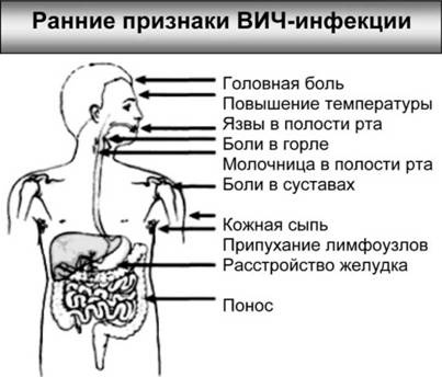 Имя ему СПИД. Четвертый всадник Апокалипсиса