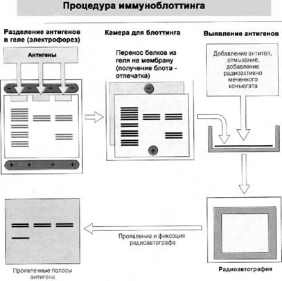 Имя ему СПИД. Четвертый всадник Апокалипсиса