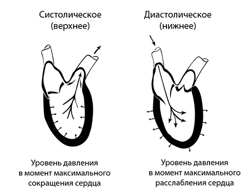 Инсульт. До и после