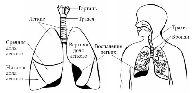 Если ваш ребенок заболел. Что должны знать и уметь родители