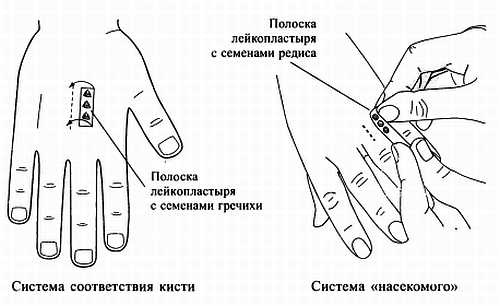 Сам себе Су Джок доктор