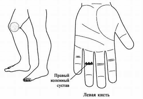 Сам себе Су Джок доктор