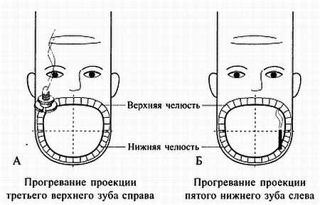 Сам себе Су Джок доктор