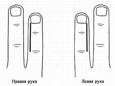 Сам себе Су Джок доктор