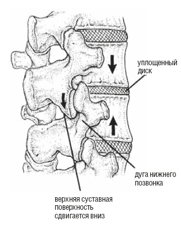 Настольная книга для тех, у кого болит спина