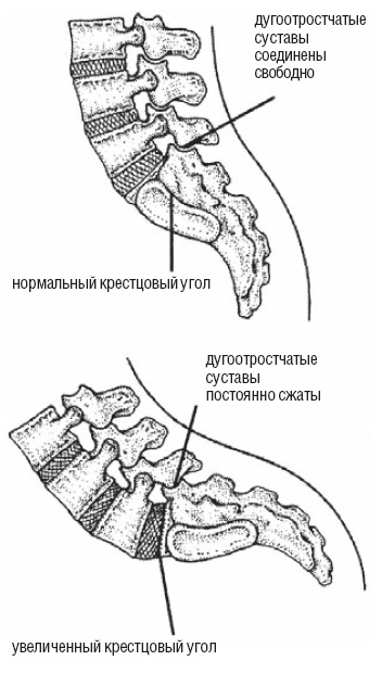 Настольная книга для тех, у кого болит спина