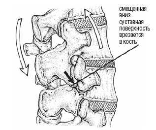 Настольная книга для тех, у кого болит спина