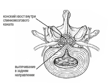 Настольная книга для тех, у кого болит спина