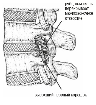 Настольная книга для тех, у кого болит спина