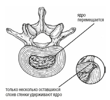 Настольная книга для тех, у кого болит спина