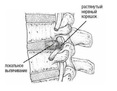 Настольная книга для тех, у кого болит спина