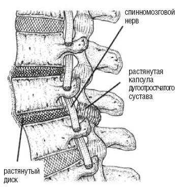 Настольная книга для тех, у кого болит спина