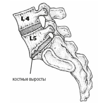 Настольная книга для тех, у кого болит спина