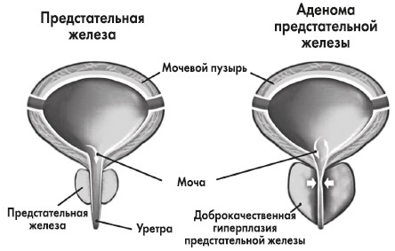 Вся правда о гормонах и не только